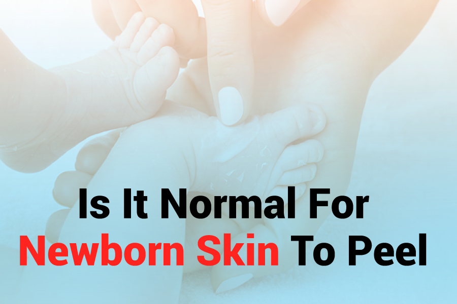 Is It Normal For Newborn Skin To Peel