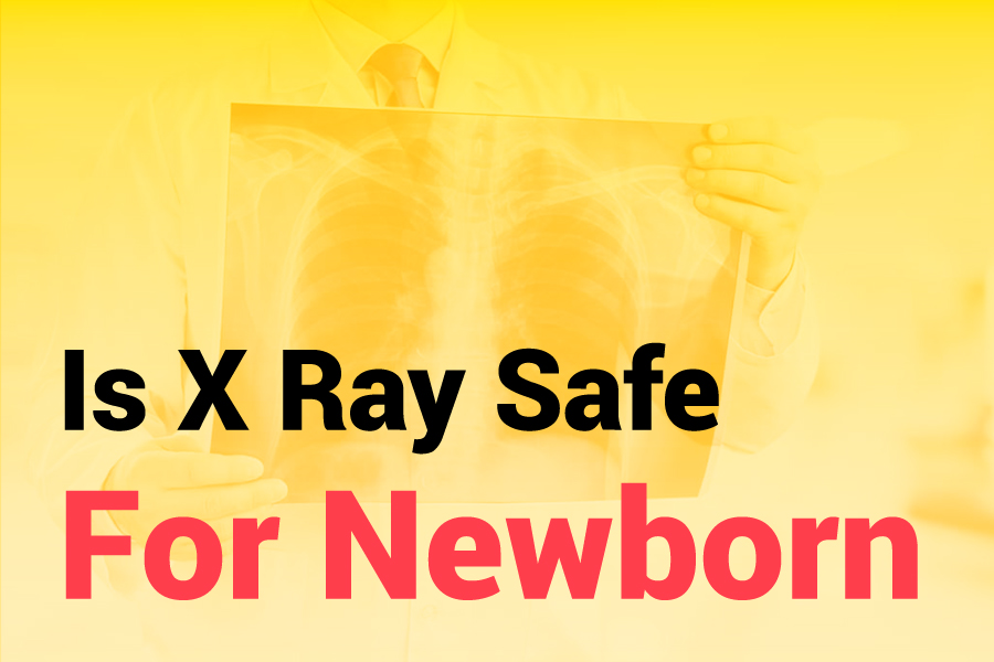 Is X-Ray Safe For Newborns